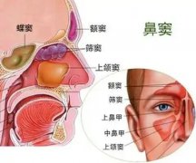 【全國(guó)愛鼻日】孩子出現(xiàn)這些癥狀，警惕鼻竇炎！